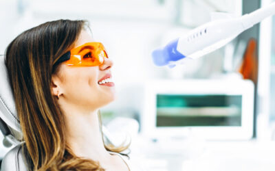 Cuánto dura un blanqueamiento dental después del tratamiento