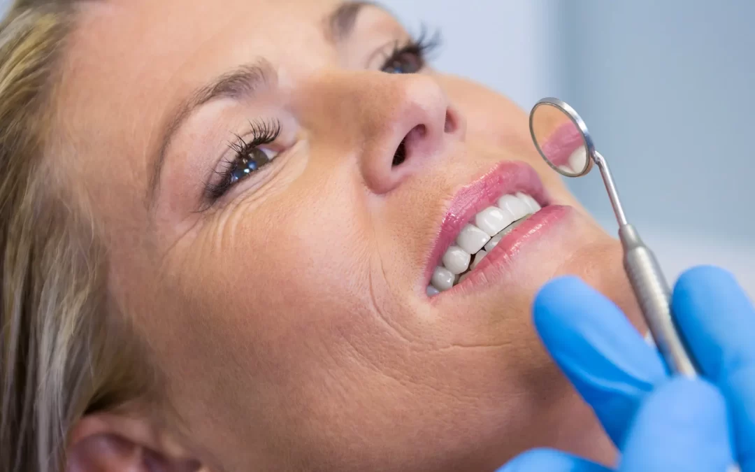 Cómo se pone una carilla dental