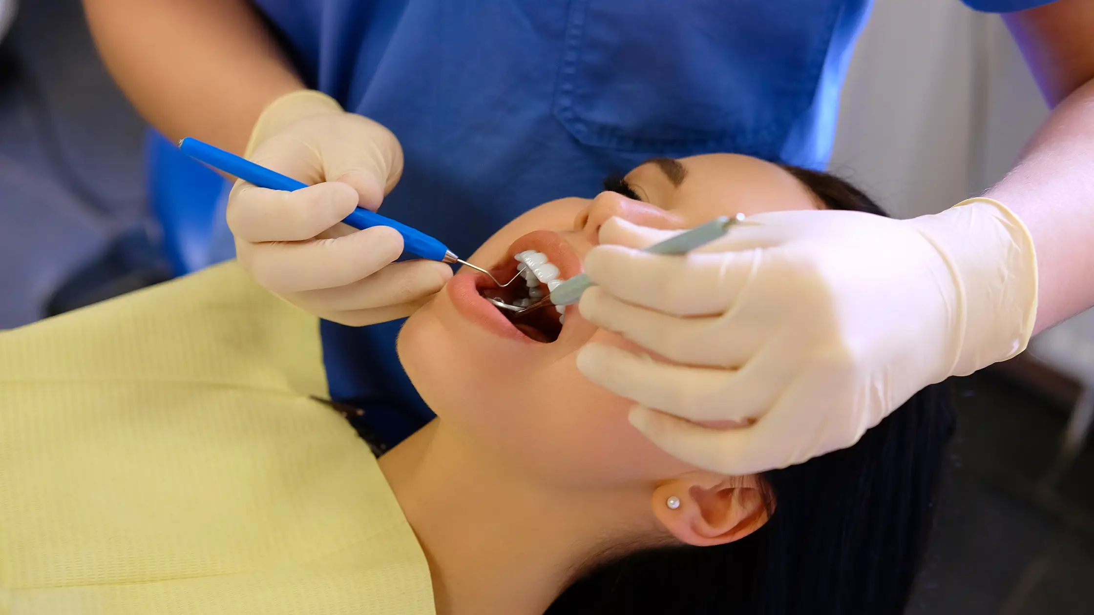 reconstrucción de muela reconstrucción de muela